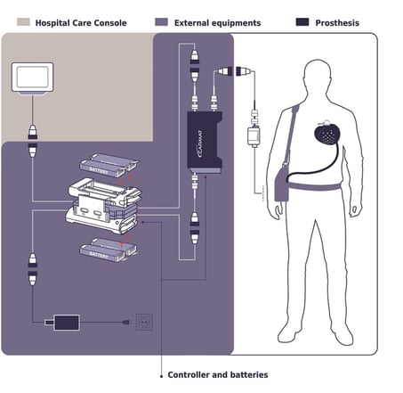 Carmat-heart-img