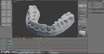 College Student 3D Prints His Own Invisalign Braces