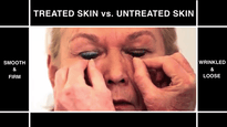 Second Skin May Reduce Wrinkles