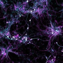 aging human brain cells