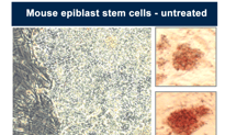 Eraser Drug Makes Stem Cells Embryonic Again