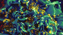 Scientists Permanently Remove HIV DNA From Human Immune Cells
