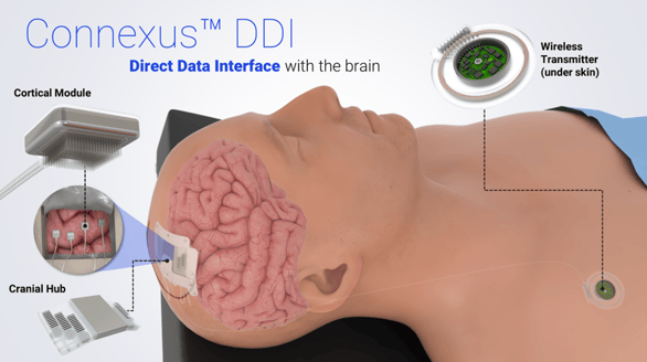 Paradromics_DDI