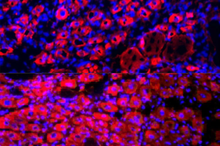 Road to Singularity - Tissue Rejuvenation