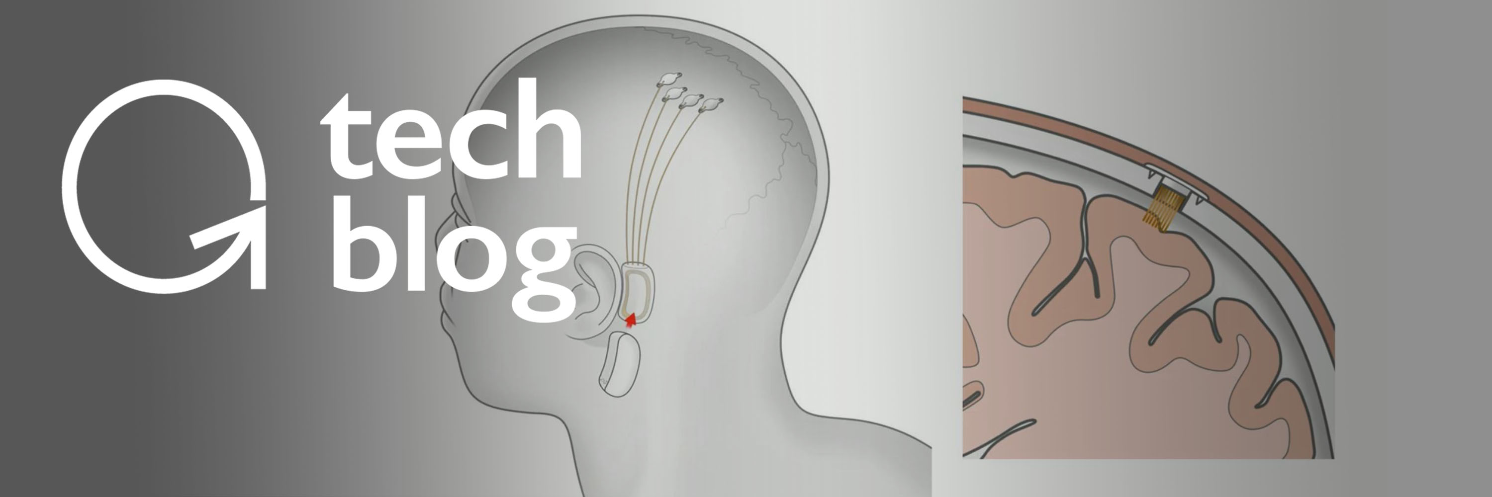 Neuralink Hardware