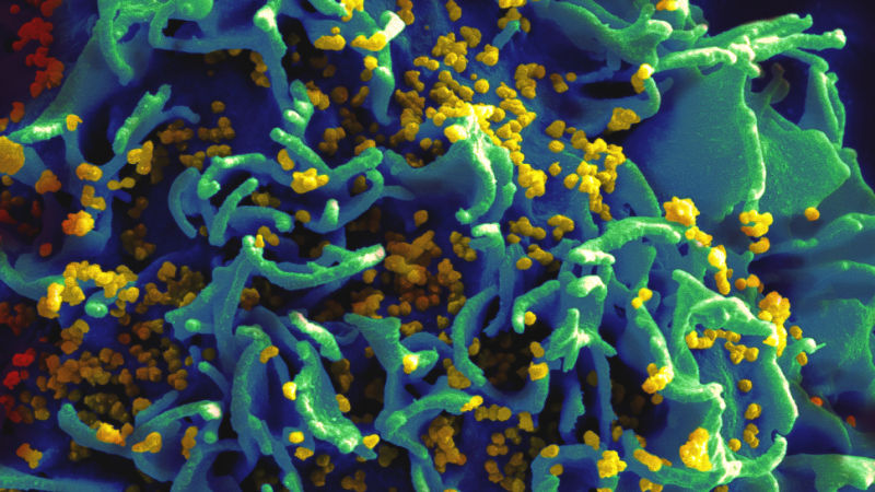 Crispr Cas9 Hiv Dna